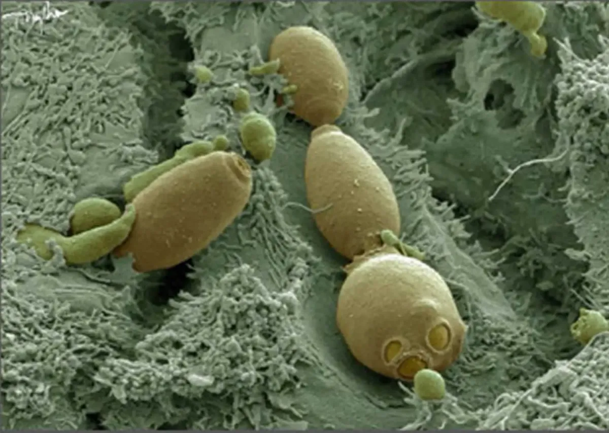 Сахаромицеты Буларди в доказательной медицине: как вписать их в здоровый образ жизни и питание