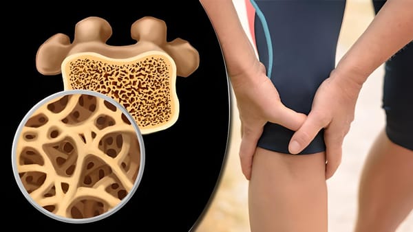 Добавки для здоровья костей после 40 лет: профилактика возрастных изменений без крайностей