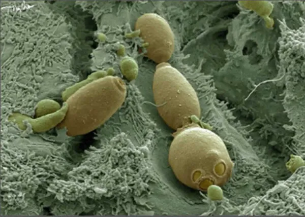 Сахаромицеты Буларди в доказательной медицине: как вписать их в здоровый образ жизни и питание